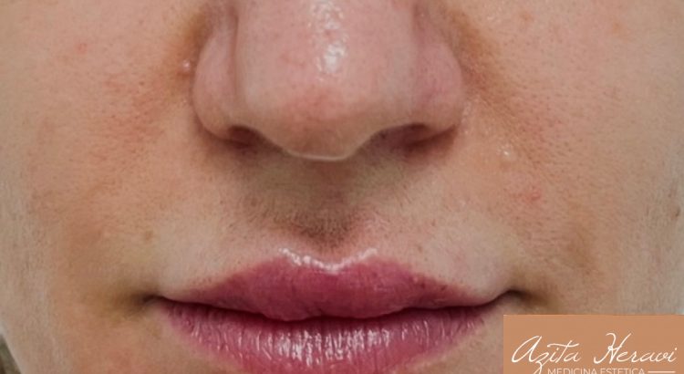 Plasma nose sculpture